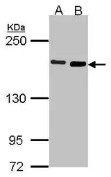 Anti-DIAPH1 antibody [N1N2], N-term used in Western Blot (WB). GTX102042