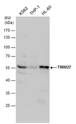 Anti-TRIM27 antibody used in Western Blot (WB). GTX102048