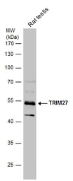 Anti-TRIM27 antibody used in Western Blot (WB). GTX102048
