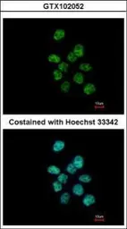 Anti-PUF60 antibody used in Immunocytochemistry/ Immunofluorescence (ICC/IF). GTX102052