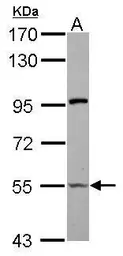 Anti-PUF60 antibody used in Western Blot (WB). GTX102052