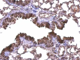 Anti-DIAPH1 antibody [C2C3], C-term used in IHC (Paraffin sections) (IHC-P). GTX102057