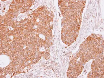 Anti-DIAPH1 antibody [C2C3], C-term used in IHC (Paraffin sections) (IHC-P). GTX102057