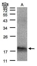 Anti-ARMET antibody [N1C3] used in Western Blot (WB). GTX102060