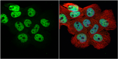 Anti-hnRNP H antibody [N1C1] used in Immunocytochemistry/ Immunofluorescence (ICC/IF). GTX102061