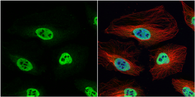 Anti-hnRNP H antibody [N1C1] used in Immunocytochemistry/ Immunofluorescence (ICC/IF). GTX102061