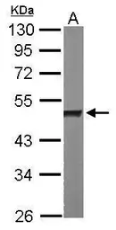 Anti-hnRNP H antibody [N1C1] used in Western Blot (WB). GTX102061