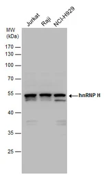 Anti-hnRNP H antibody [N1C1] used in Western Blot (WB). GTX102061