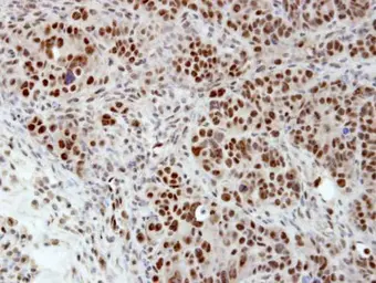 Anti-hnRNP H antibody [N1C1] used in IHC (Paraffin sections) (IHC-P). GTX102061