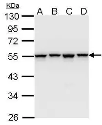Anti-hnRNP H antibody [N1C1] used in Western Blot (WB). GTX102061