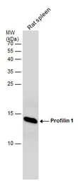 Anti-Profilin 1 antibody [N1C3] used in Western Blot (WB). GTX102072