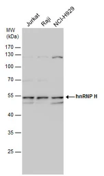 Anti-hnRNP H antibody [C1C3] used in Western Blot (WB). GTX102083