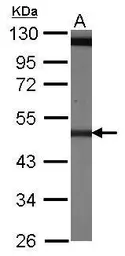 Anti-beta Tubulin 4 antibody used in Western Blot (WB). GTX102095