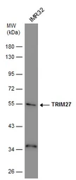 Anti-TRIM27 antibody used in Western Blot (WB). GTX102098