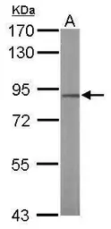 Anti-NULP1 antibody [C1C3] used in Western Blot (WB). GTX102102