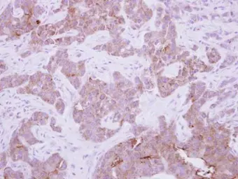 Anti-CPNE6 antibody used in IHC (Paraffin sections) (IHC-P). GTX102120