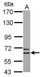Anti-CPNE6 antibody used in Western Blot (WB). GTX102120