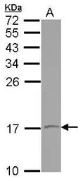 Anti-VAMP1 antibody used in Western Blot (WB). GTX102127