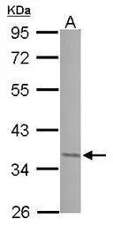 Anti-JunD antibody [N1C1] used in Western Blot (WB). GTX102135
