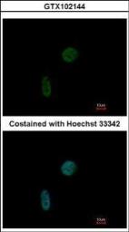 Anti-CIZ1 antibody [N2C1], Internal used in Immunocytochemistry/ Immunofluorescence (ICC/IF). GTX102144