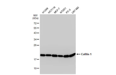 Anti-Cofilin 1 antibody used in Western Blot (WB). GTX102156