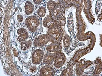 Anti-TMED9 antibody [N1C3] used in IHC (Paraffin sections) (IHC-P). GTX102163