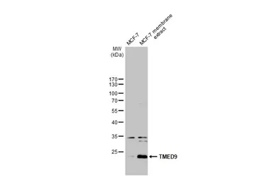 Anti-TMED9 antibody [N1C3] used in Western Blot (WB). GTX102163