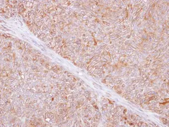 Anti-TMED9 antibody [N1C3] used in IHC (Paraffin sections) (IHC-P). GTX102163