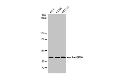 Anti-RanBP16 antibody [C2C3], C-term used in Western Blot (WB). GTX102166