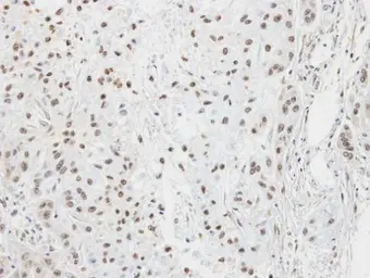 Anti-LZIP antibody [C1C3] used in IHC (Paraffin sections) (IHC-P). GTX102169