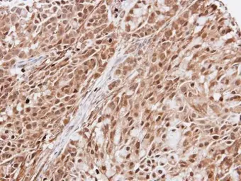 Anti-KIAA0494 antibody [N3C3] used in IHC (Paraffin sections) (IHC-P). GTX102173