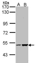 Anti-KIAA0494 antibody [N3C3] used in Western Blot (WB). GTX102173