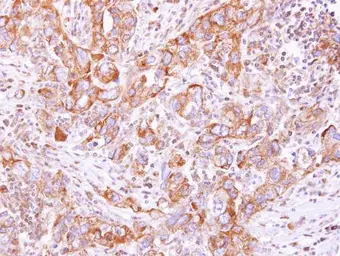 Anti-Lysyl-tRNA synthetase antibody used in IHC (Paraffin sections) (IHC-P). GTX102179