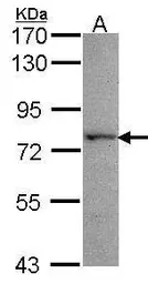 Anti-Lysyl-tRNA synthetase antibody used in Western Blot (WB). GTX102179