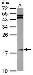 Anti-SUMO2 + SUMO3 antibody used in Western Blot (WB). GTX102190