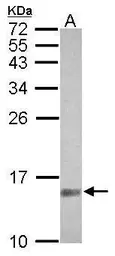 Anti-SUMO2 + SUMO3 antibody used in Western Blot (WB). GTX102190