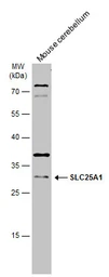 Anti-SLC25A1 antibody [N1C1] used in Western Blot (WB). GTX102191