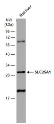 Anti-SLC25A1 antibody [N1C1] used in Western Blot (WB). GTX102191