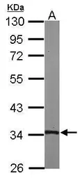 Anti-TSFM antibody [N1C1] used in Western Blot (WB). GTX102192