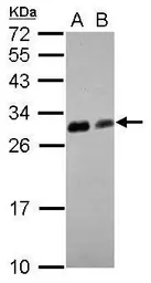 Anti-14-3-3 theta antibody used in Western Blot (WB). GTX102199