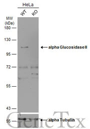 Anti-alpha Glucosidase II antibody [C2C3], C-term used in Western Blot (WB). GTX102205