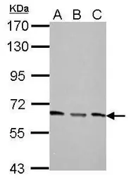 Anti-PPP2R1A antibody used in Western Blot (WB). GTX102206