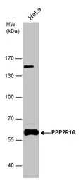 Anti-PPP2R1A antibody used in Western Blot (WB). GTX102206