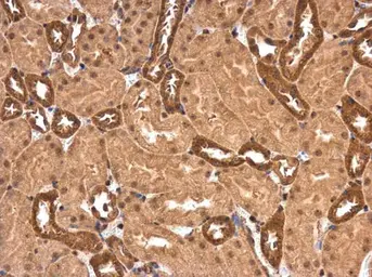Anti-PPP2R1A antibody used in IHC (Paraffin sections) (IHC-P). GTX102206