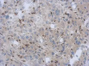 Anti-NDUFV1 antibody [N3C3] used in IHC (Paraffin sections) (IHC-P). GTX102209