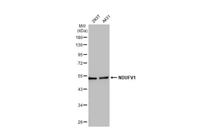 Anti-NDUFV1 antibody [N3C3] used in Western Blot (WB). GTX102209