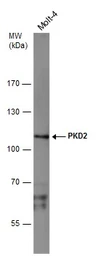 Anti-PKD2 antibody [C1C3] used in Western Blot (WB). GTX102212