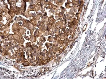 Anti-PKD2 antibody [C1C3] used in IHC (Paraffin sections) (IHC-P). GTX102212