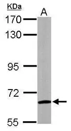 Anti-WDR1 antibody used in Western Blot (WB). GTX102214