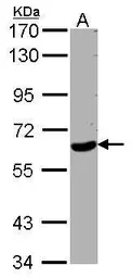 Anti-WDR1 antibody used in Western Blot (WB). GTX102214